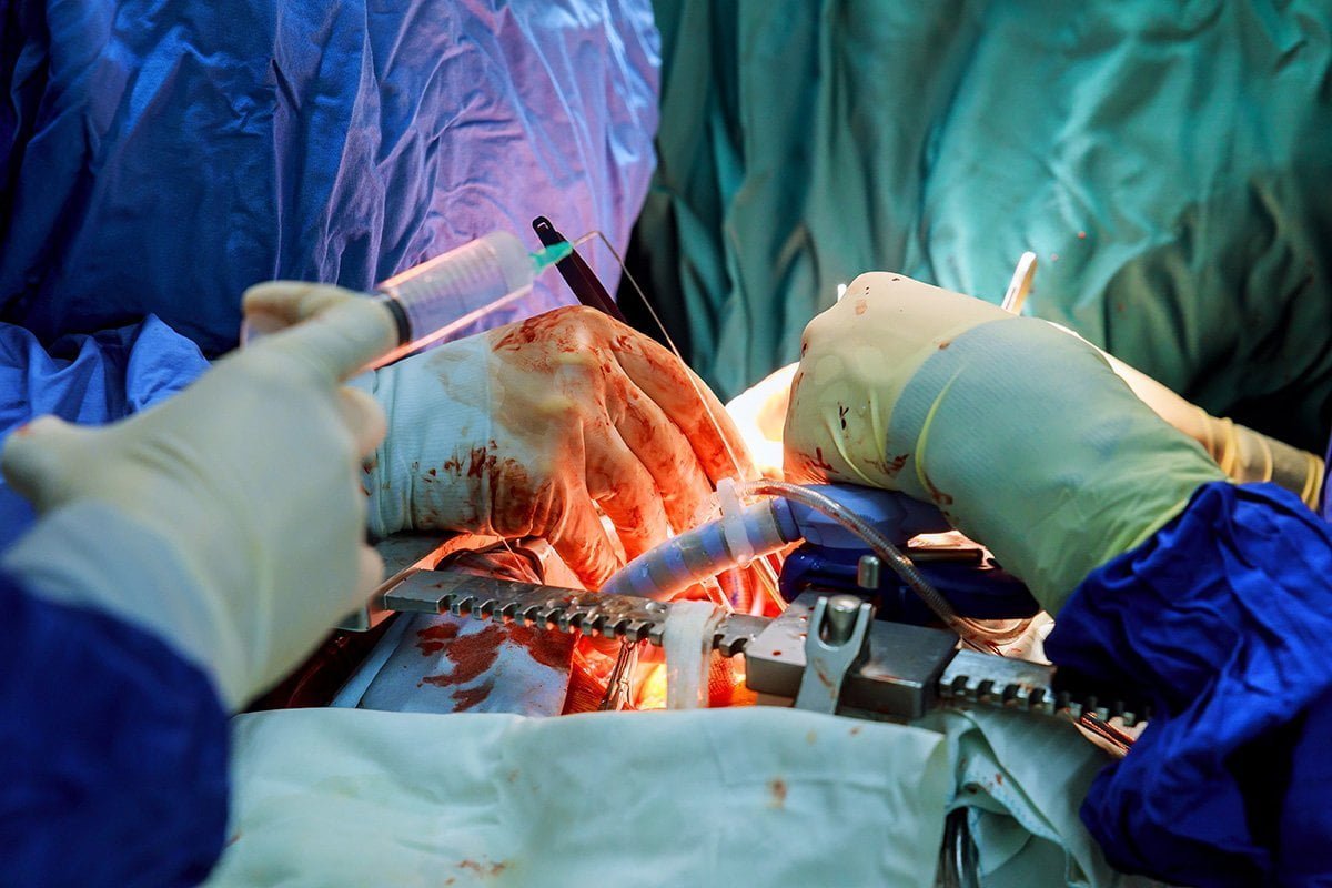 Cardiothoracic Surgery