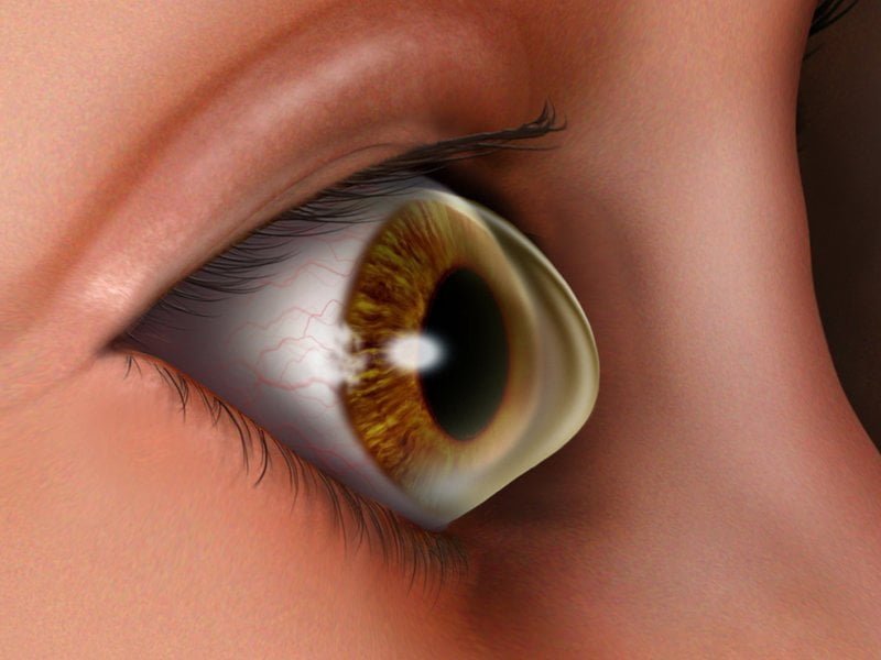 Cornea