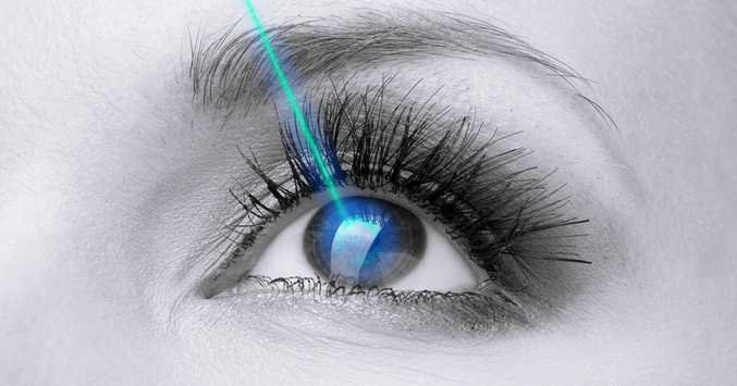Refractive surgery