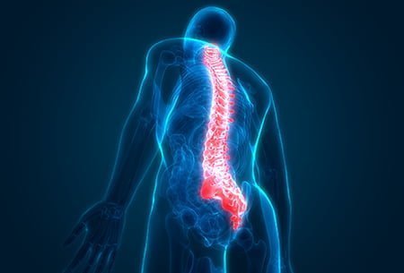 Spine surgery cost in india