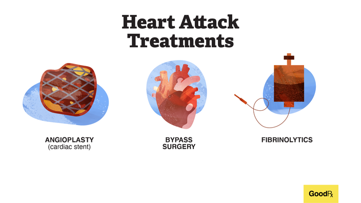What Are The Different Treatment Options For Heart Disease?