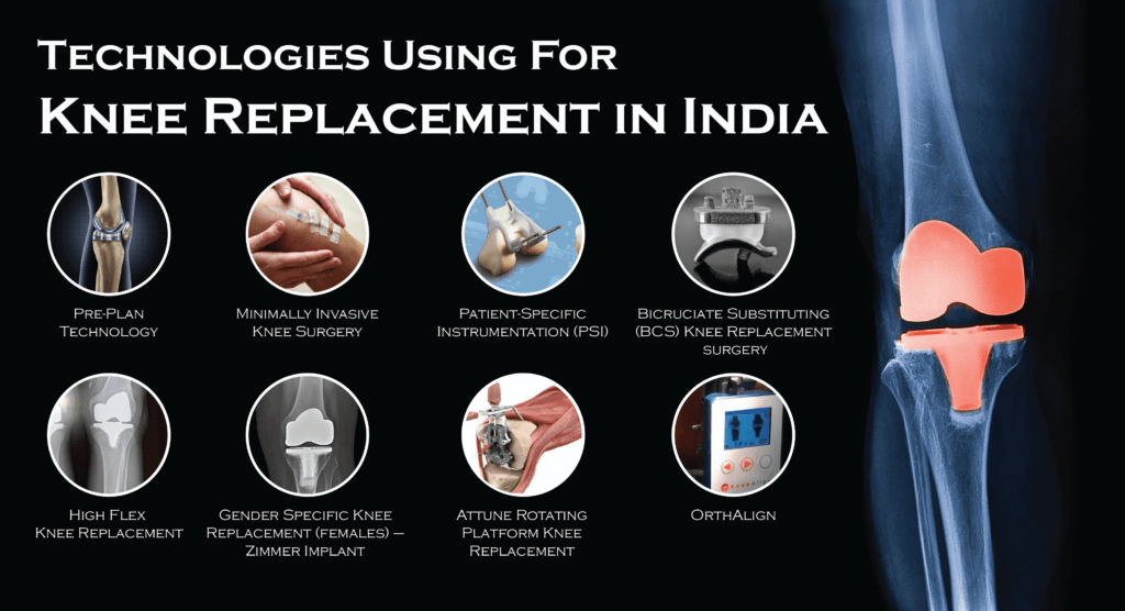 Minimally Invasive Total Knee Replacement Surgery & Procedures In India