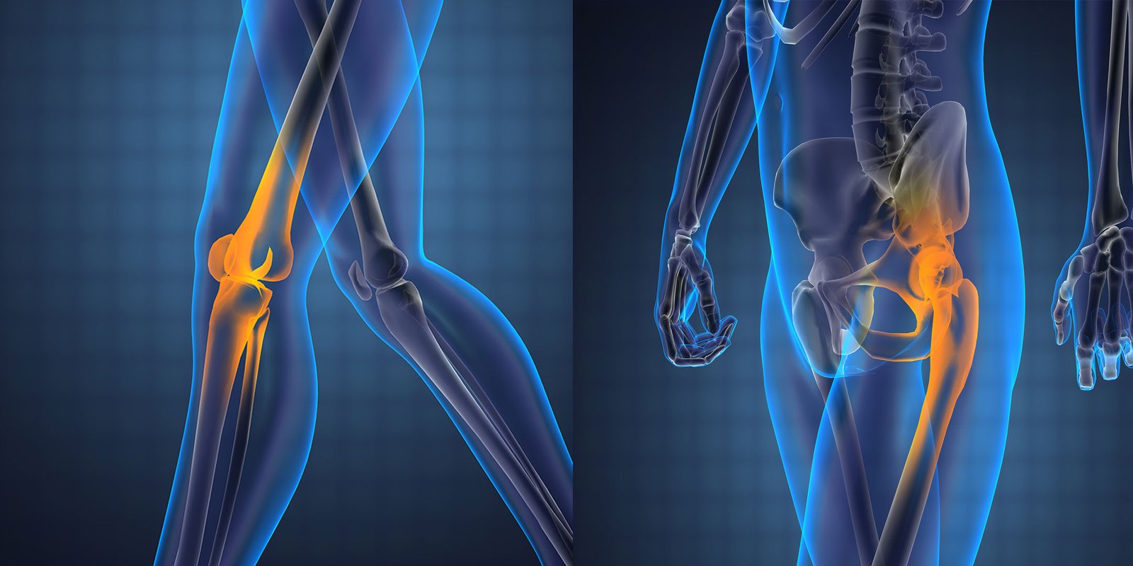 HIP Replacement & Knee Replacement Surgery HIP Replacement & Knee Replacement Surgery