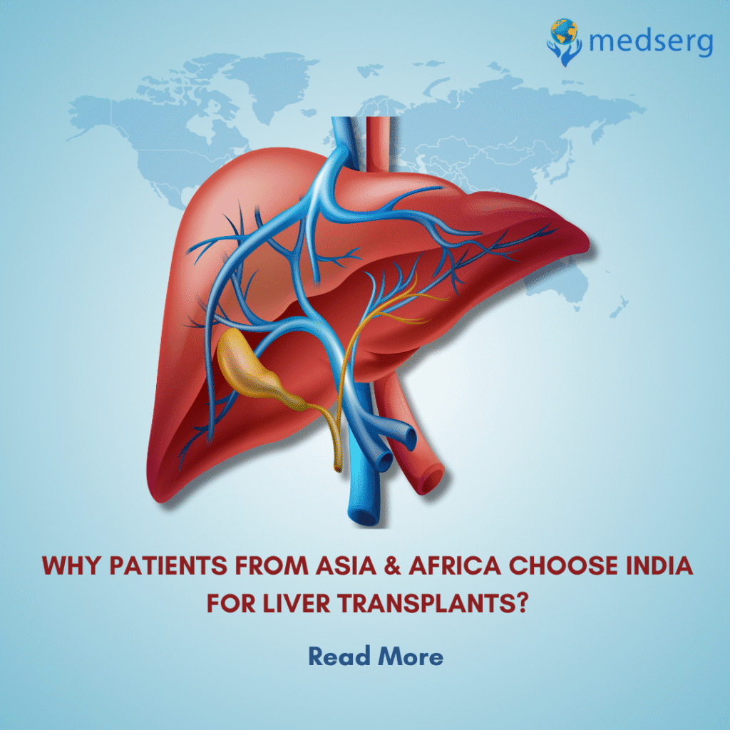 Why Patients from Asia & Africa Choose India for Liver Transplants