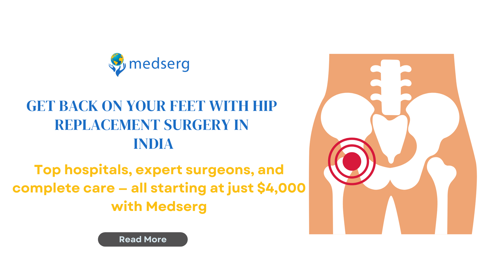 Hip Replacement Surgery in India