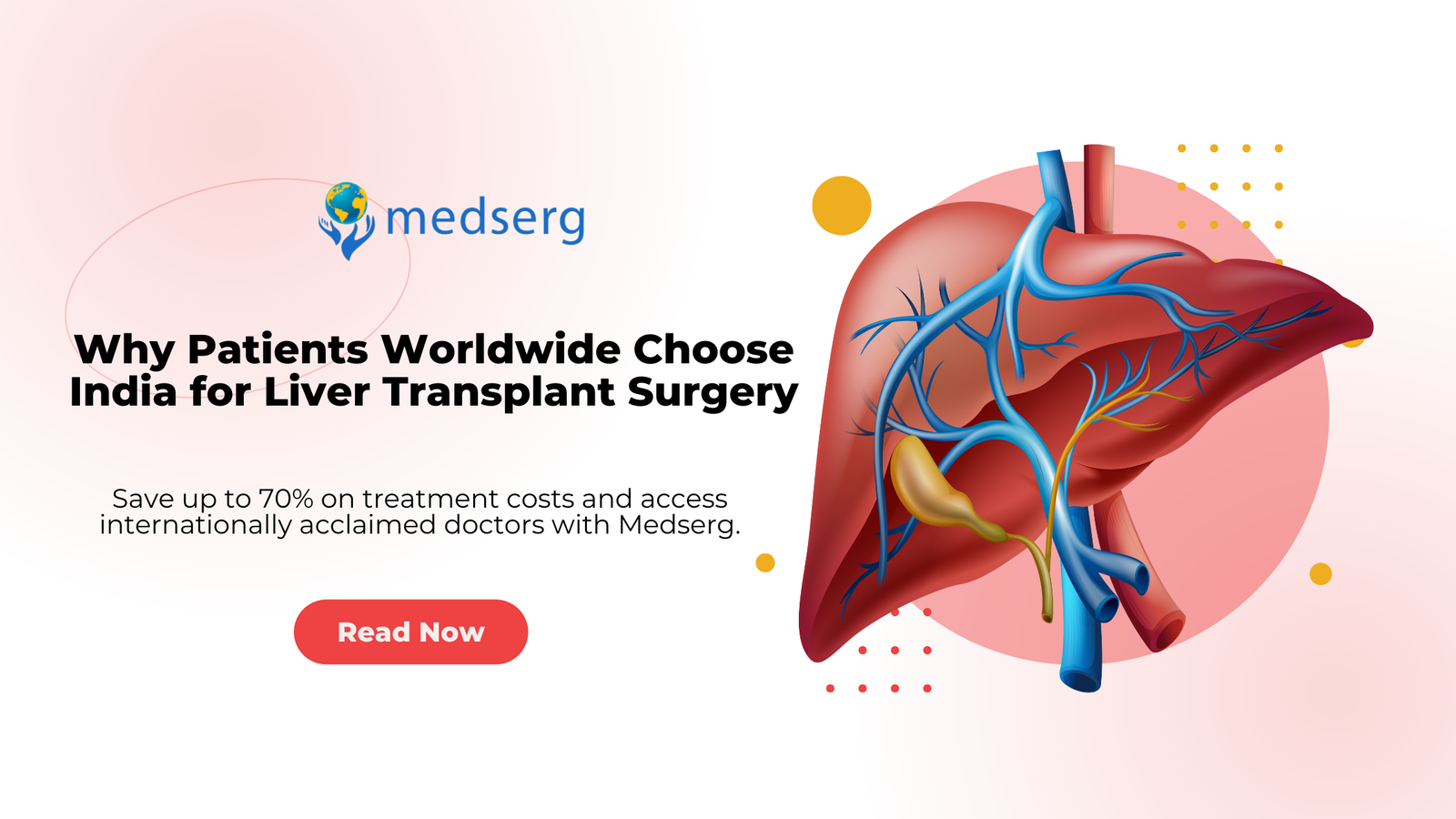 Liver Transplant in India