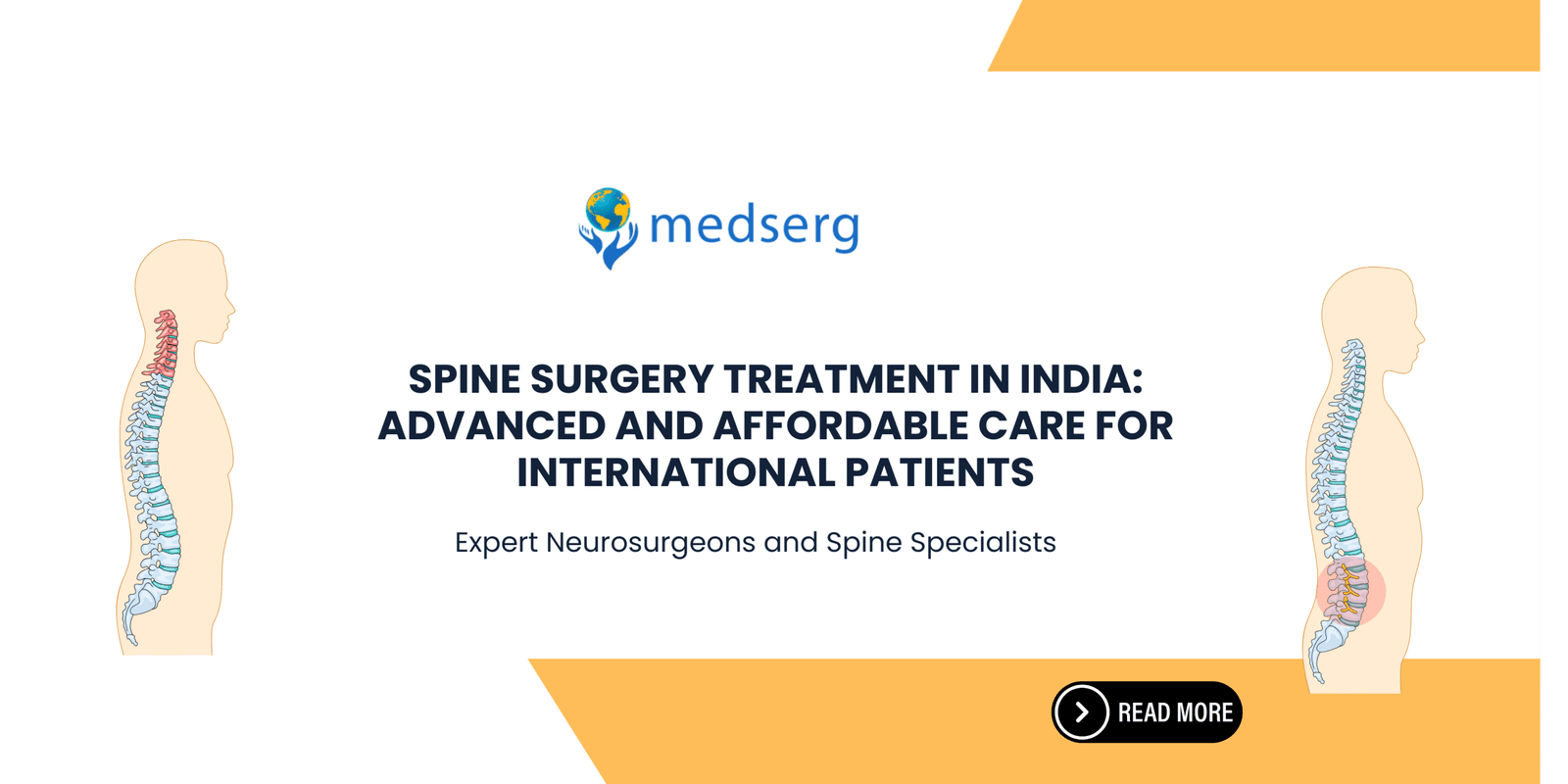 Spine Surgery Treatment in India Advanced and Affordable Care for International Patients