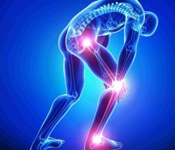 Orthopedics
